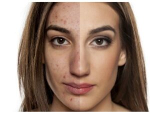 plastic surgery Costa Mesa CA