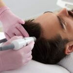 non-surgical hair loss treatment New Jersey