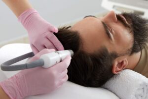 non-surgical hair loss treatment New Jersey