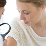 mole treatment Costa Mesa CA