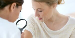 mole treatment Costa Mesa CA